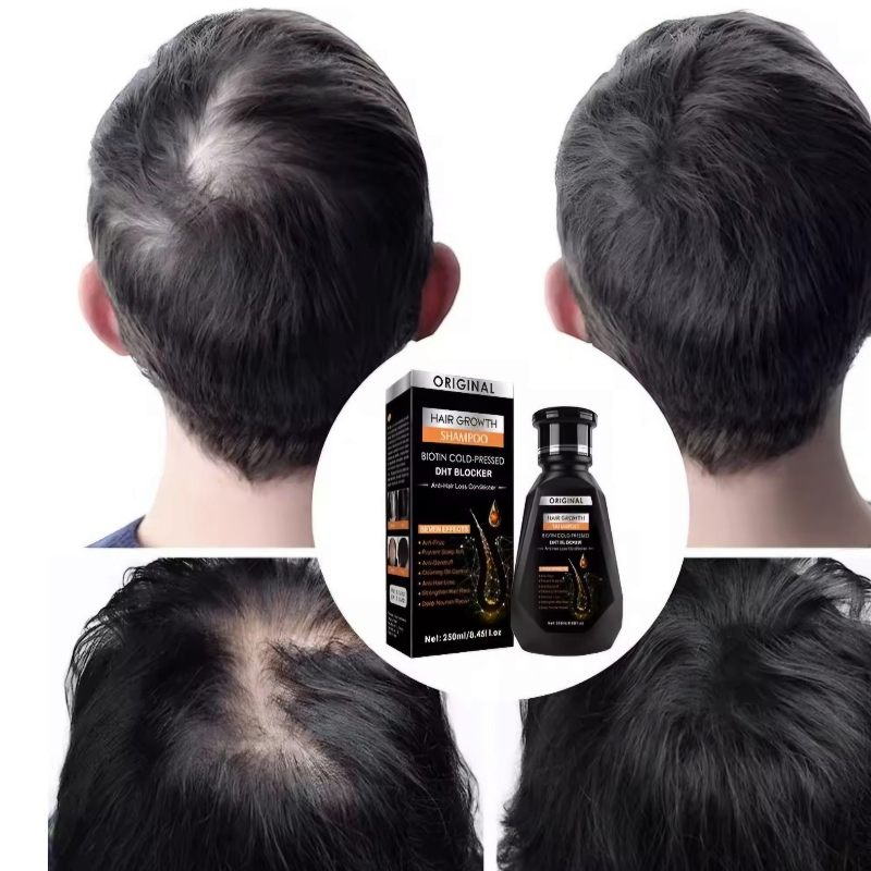 Hair Growth Shampoo -Biotin